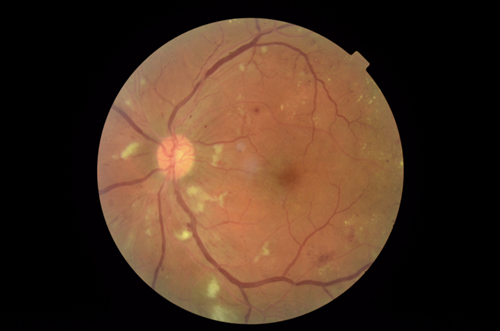 Imagem relacionada a 4 formas que a AI do Google está ajudando a sociedade